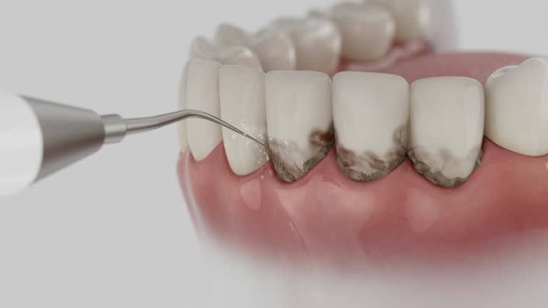 Reliable Root Canal Treatment contractor in Hardin County County, OH by Dentist Open Now